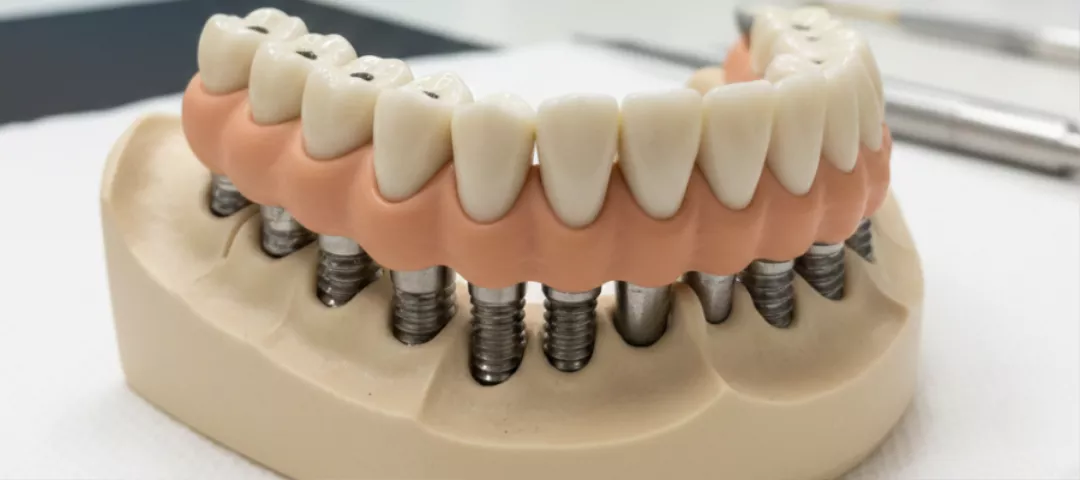 dis-beyazlatma-1-2-694a59e1b9d82