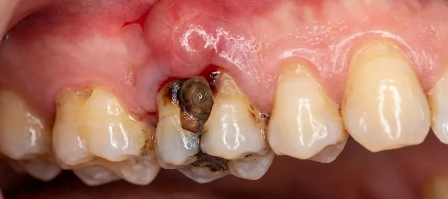 dis-lezyonu-694a7d9d72188