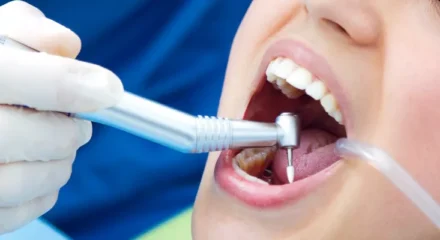 dis-tasi-temizligi-694a507fbb72a