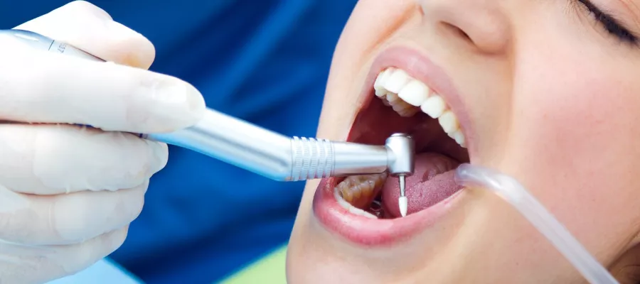 dis-tasi-temizligi-694a507fbb72a