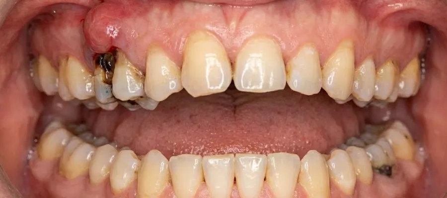 kuretaj-694a817c61526