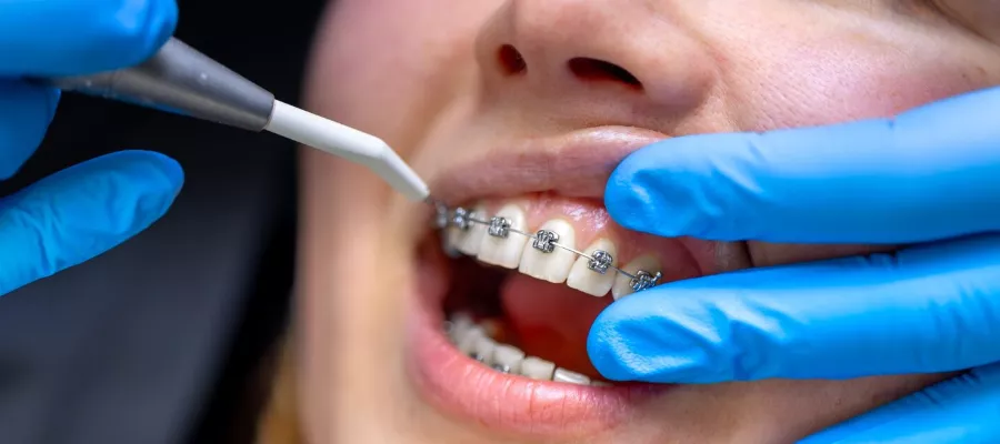 ortodontik-tedavi-694a667c7fe82
