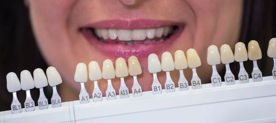 porselen-dis-kaplama