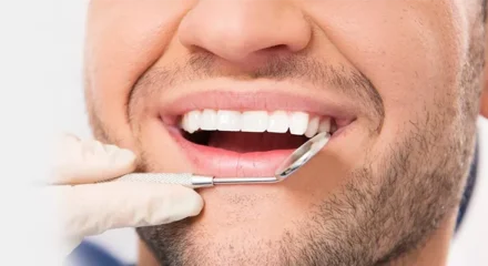 porselen-kuron-kaplama-694a7e9e93b20