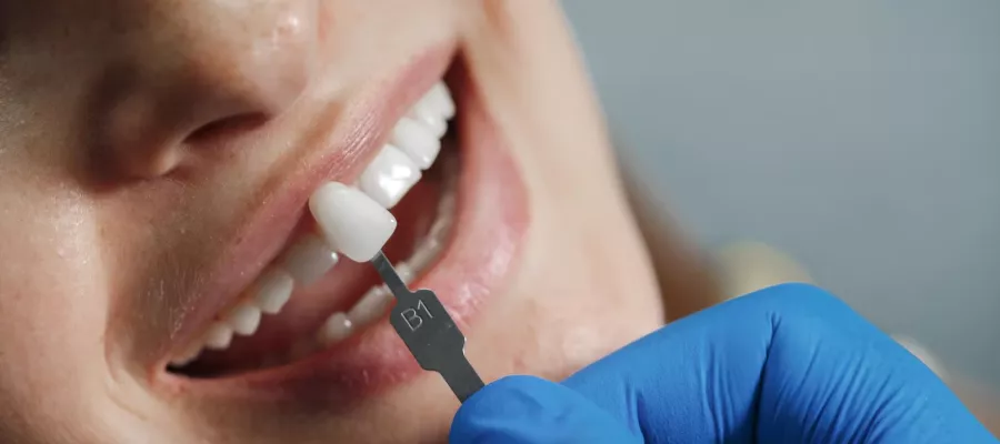 porselen-lamina-694a873a1b322