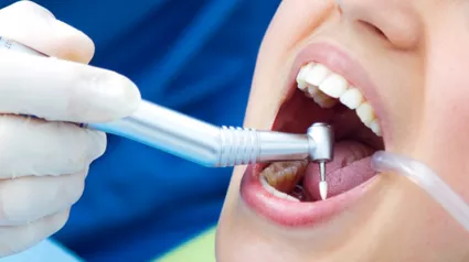 dis-tasi-temizligi-2-694a5083ac51c