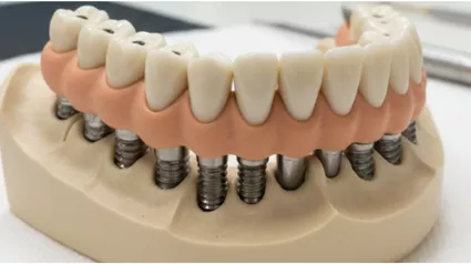 kron-kopru-694a59a12579f